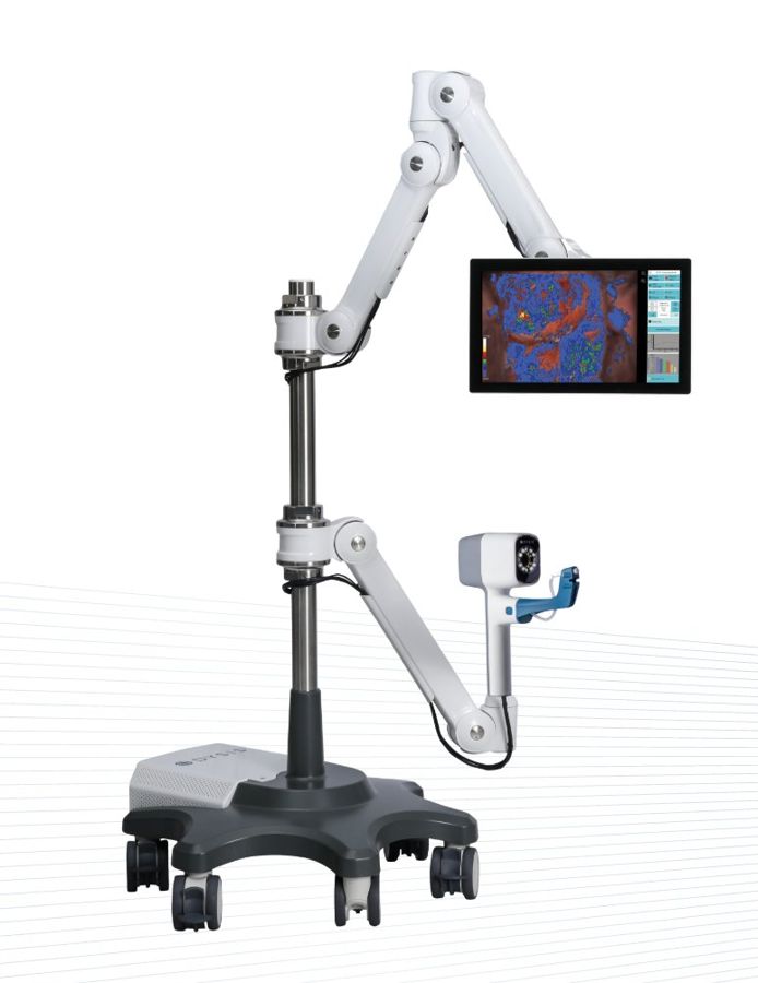 Video · Colposcopy