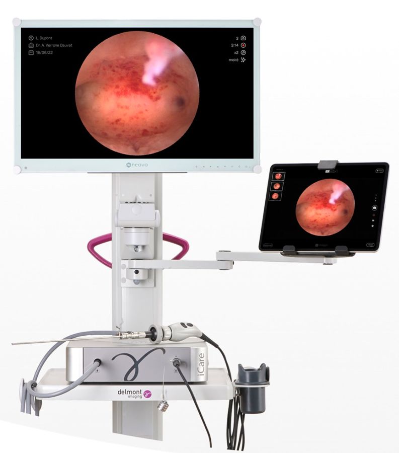 Video · Hysteroscopy